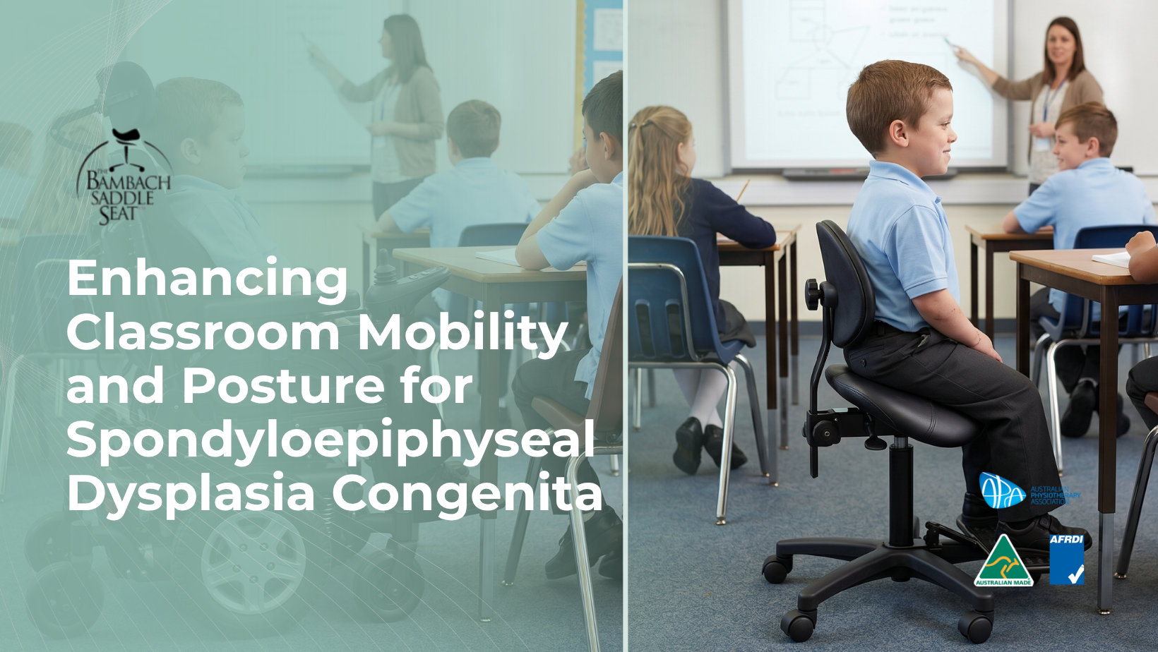 spondyloepiphyseal dysplasia seating
